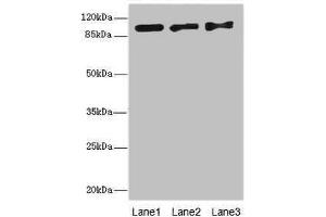 Western blot All lanes: EXO1 antibody at 10 μg/mL Lane 1: Hela whole cell lysate Lane 2: 293T whole cell lysate Lane 3: A549 whole cell lysate Secondary Goat polyclonal to rabbit IgG at 1/10000 dilution Predicted band size: 95, 90 kDa Observed band size: 95 kDa (Exonuclease 1 antibody  (AA 301-600))