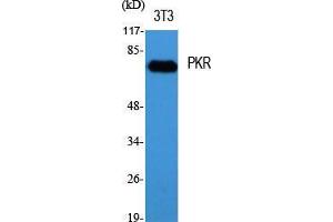 Western Blotting (WB) image for anti-Eukaryotic Translation Initiation Factor 2-alpha Kinase 2 (EIF2AK2) (Thr392) antibody (ABIN3186490)