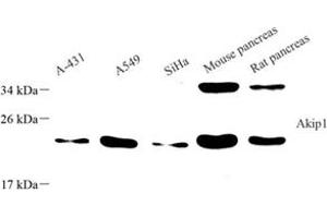 Western blot analysis of Akip1 (ABIN7072871) at dilution of 1: 800