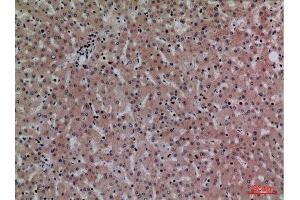 Immunohistochemistry (IHC) analysis of paraffin-embedded Human Liver, antibody was diluted at 1:100. (CRP antibody  (Internal Region))