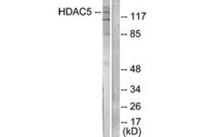 Western blot analysis of extracts from HepG2 cells, treated with PMA 125ng/ml 30', using HDAC5 Antibody. (HDAC5 antibody  (AA 1073-1122))