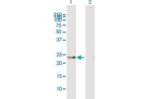 Western Blot analysis of PRDX4 expression in transfected 293T cell line by PRDX4 MaxPab polyclonal antibody. (Peroxiredoxin 4 antibody  (AA 1-271))