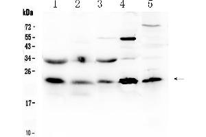 Western blot analysis of HSPB8/Hsp22 using anti- HSPB8/Hsp22 antibody . (HSPB8 antibody  (AA 1-196))