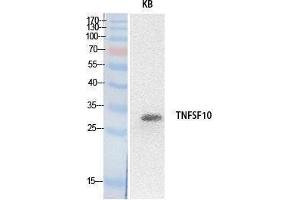 Western Blotting (WB) image for anti-Tumor Necrosis Factor (Ligand) Superfamily, Member 10 (TNFSF10) (Internal Region) antibody (ABIN3178527) (TRAIL antibody  (Internal Region))