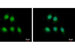 ICC/IF Image MAGE 1 antibody [N1C3] detects MAGE 1 protein at nucleus and cytoplasm by immunofluorescent analysis. (Melanoma Antigen Family D, 4 (MAGED4) (Center) antibody)