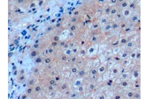 Detection of ICOSLG in Human Liver Tissue using Polyclonal Antibody to Inducible T-Cell Co Stimulator Ligand (ICOSLG) (ICOSLG antibody  (AA 23-249))