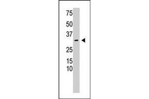 The RCAN3 polyclonal antibody  is used in Western blot to detect RCAN3 in mouse heart tissue lysate. (RCAN3 antibody  (N-Term))