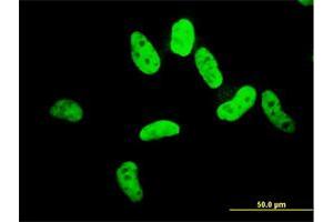 Immunofluorescence of monoclonal antibody to ZNF207 on HeLa cell. (ZNF207 antibody  (AA 1-110))