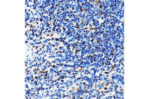 Immunohistochemistry of paraffin-embedded rat spleen using CRM1/XPO1 antibody (ABIN7267067) at dilution of 1:100 (40x lens). (XPO1 antibody)