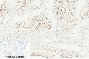 Immunohistochemical analysis of paraffin-embedded human breast tissue. (Caspase 8 antibody  (Cleaved-Asp384))