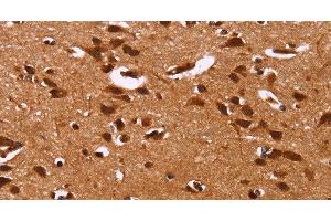 Immunohistochemistry of paraffin-embedded Human brain tissue using HRK Polyclonal Antibody at dilution 1:40 (HRK antibody)