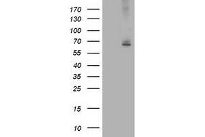Western Blotting (WB) image for anti-IlvB (Bacterial Acetolactate Synthase)-Like (ILVBL) antibody (ABIN1498881) (ILVBL antibody)