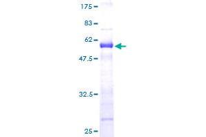Image no. 1 for Protein Phosphatase 1, Regulatory (Inhibitor) Subunit 2 Pseudogene 3 (PPP1R2P3) (AA 1-205) protein (GST tag) (ABIN1315983) (PPP1R2P3 Protein (AA 1-205) (GST tag))