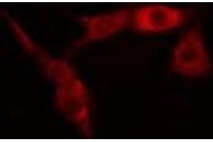 ABIN6275495 staining COLO205 cells by IF/ICC. (ARHGEF11 antibody  (C-Term))
