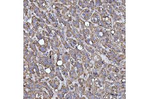 IHC analysis of MRPS22 using anti-MRPS22 antibody (ABIN7600613). (MRPS22 antibody  (AA 21-329))
