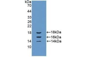 Detection of Recombinant IL15, Bovine using Polyclonal Antibody to Interleukin 15 (IL15) (IL-15 antibody  (AA 48-162))
