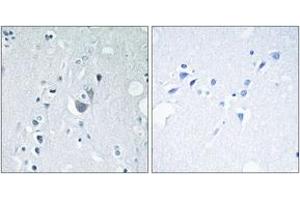 Immunohistochemistry analysis of paraffin-embedded human brain, using SAPK/JNK (Phospho-Tyr185) Antibody. (SAPK, JNK (AA 151-200), (pTyr185) antibody)