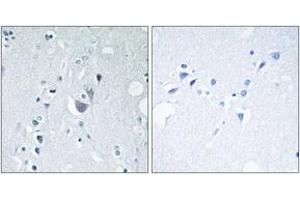 Immunohistochemistry analysis of paraffin-embedded human brain, using SAPK/JNK (Phospho-Tyr185) Antibody. (SAPK, JNK (AA 151-200), (pTyr185) antibody)