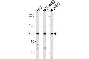 Western blot analysis of lysates from Hela, NCI-H460, HUVEC cell line (from left to right), using EPHA4 Antibody (R890) at 1:1000 at each lane. (EPH Receptor A4 antibody  (C-Term))