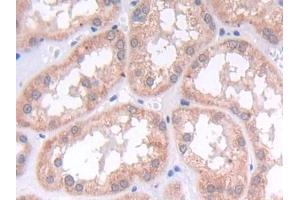 DAB staining on IHC-P; Samples: Human Kidney Tissue (LAMB2 antibody  (AA 38-350))