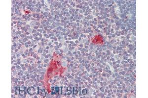 Immunohistochemistry (IHC) image for anti-Tumor Necrosis Factor (Ligand) Superfamily, Member 8 (TNFSF8) (AA 68-231) antibody (ABIN7431086)