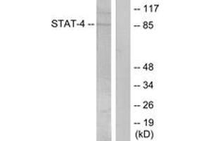 Western blot analysis of extracts from HeLa cells treated with IL-4, using STAT4 (Phospho-Tyr693) Antibody. (STAT4 antibody  (pTyr693))