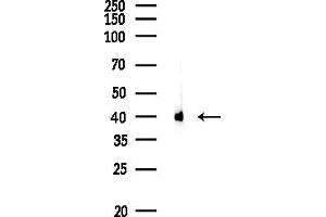 anti-Creatine Kinase, Mitochondrial 1, Ubiquitous (CKMT1) (N-Term) antibody