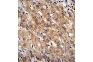 Immunohistochemistry analysis in human liver tissue (formalin-fixed, paraffin-embedded) using CHCHD4 / MIA40 Antibody (C-term), followed by peroxidase conjugation of the secondary antibody and DAB staining. (CHCHD4 antibody  (C-Term))