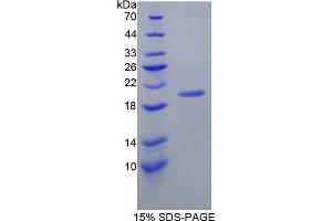 SDS-PAGE (SDS) image for Lymphotoxin beta Receptor (TNFR Superfamily, Member 3) (LTBR) (AA 66-215) protein (His tag) (ABIN1170888) (LTBR Protein (AA 66-215) (His tag))