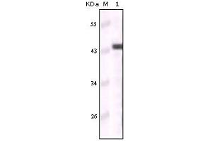 Western blot analysis using CK5 mouse mAb against truncated CK5 recombinant protein (Cytokeratin 5 antibody)
