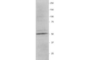Western Blotting (WB) image for anti-Vimentin (VIM) antibody (ABIN955516) (Vimentin antibody)