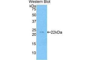 Western Blotting (WB) image for anti-Cathelicidin Antimicrobial Peptide (CAMP) (AA 31-170) antibody (ABIN1858227) (Cathelicidin antibody  (AA 31-170))
