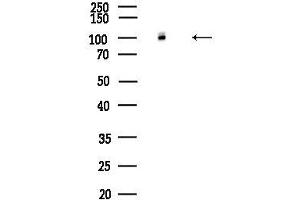 anti-ATPase, Na+/K+ Transporting, alpha 2 Polypeptide (ATP1A2) (N-Term) antibody