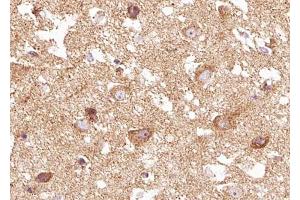 ABIN6267671 at 1/100 staining human brain tissue sections by IHC-P. (TRKB antibody  (pTyr516))