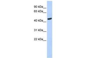 Image no. 1 for anti-Tryptophanyl-tRNA Synthetase (WARS) (AA 35-84) antibody (ABIN6749767)