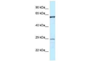 Western Blot showing PTPN6 antibody used at a concentration of 1 ug/ml against THP-1 Cell Lysate (SHP1 antibody  (Middle Region))