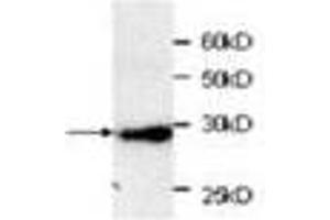 Image no. 1 for anti-Red Fluorescent Protein (RFP) (AA 21-245) antibody (ABIN791466) (RFP antibody  (AA 21-245))