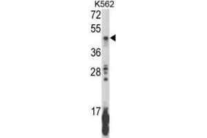 Western Blotting (WB) image for anti-Killer Cell Immunoglobulin-Like Receptor, Two Domains, Long Cytoplasmic Tail, 5B (KIR2DL5B) antibody (ABIN3003959)