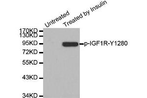 Western blot analysis of extract from 293 cells, using Phospho-IGF1R-Y1280 antibody (ABIN2988067). (IGF1R antibody  (pTyr1280))