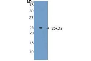 Detection of Recombinant ADCY6, Mouse using Polyclonal Antibody to Adenylate Cyclase 6 (ADCY6) (ADCY6 antibody  (AA 314-501))