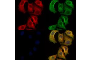 ABIN6261918 and ABIN6278469 staining Hela cells by IF/ICC. (GUCY1B2 antibody  (C-Term))
