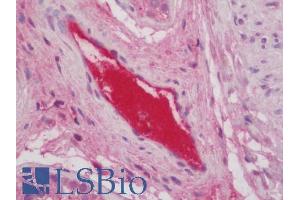 ABIN1049512 (5µg/ml) staining of paraffin embedded Human Testis. (C3 antibody  (AA 1580-1592))