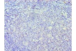 Immunohistochemistry of paraffin-embedded human tonsil tissue using ABIN7156635 at dilution of 1:100 (IRF8 antibody  (AA 137-426))