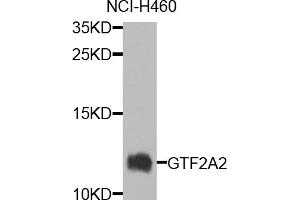 Western blot analysis of extracts of NCI-H460 cells, using GTF2A2 antibody.