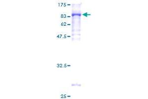 NMT2 Protein (AA 1-498) (GST tag)