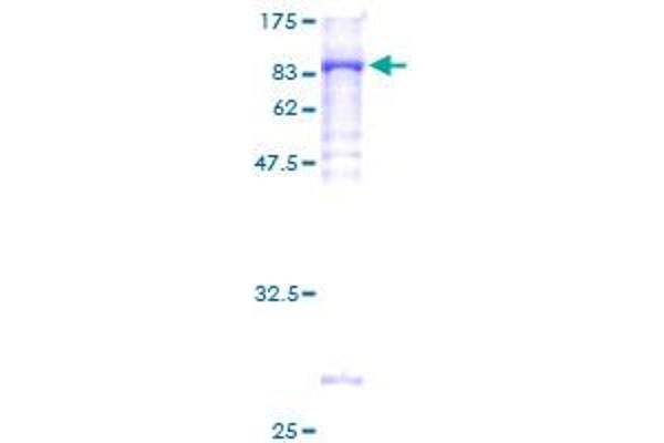 NMT2 Protein (AA 1-498) (GST tag)