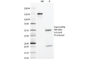 SDS-PAGE Analysis of Purified, BSA-Free Alpha 1 Antitrypsin Antibody (clone AAT/1378).
