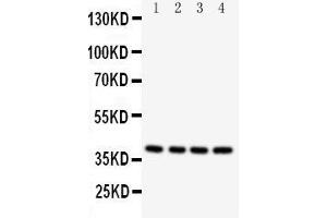 Western Blotting (WB) image for anti-Caspase 12 (Gene/pseudogene) (CASP12) (AA 71-84), (N-Term) antibody (ABIN3042658) (Caspase 12 antibody  (N-Term))