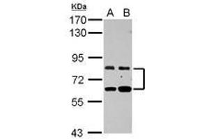 Image no. 1 for anti-Zinc Finger Protein 64 (ZFP64) (AA 394-681) antibody (ABIN1501818) (ZFP64 antibody  (AA 394-681))