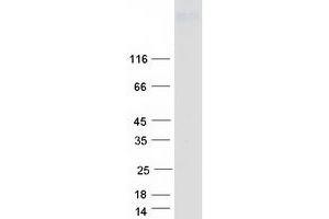 Western Blotting (WB) image for Protein tyrosine Phosphatase, Receptor Type, B (PTPRB) (Transcript Variant 1) protein (Myc-DYKDDDDK Tag) (ABIN2730129)